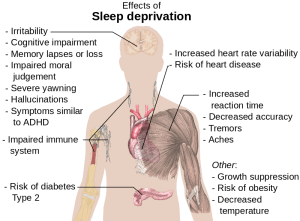 800px-Effects_of_sleep_deprivation.svg