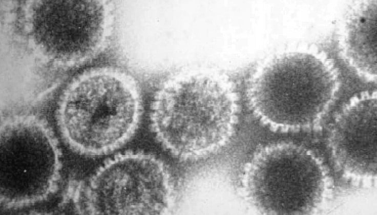 virus