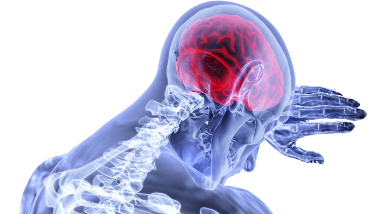 brain injury lawyer
