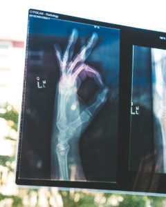 x-ray-ok